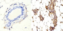 RhoA Antibody (1A11-4G10), Novus Biologicals 0.1mg; Unlabeled:Antibodies,
