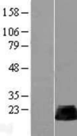 Novus Biologicals&trade;&nbsp;RhoB Overexpression Lysate