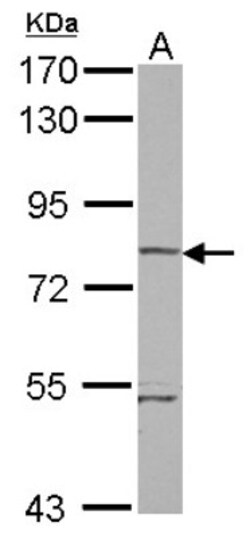 RHOBTB1 Antibody, Novus Biologicals 0.1mL; Unlabeled:Antibodies, Polyclonal