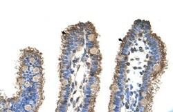 RHOBTB1 Antibody, Novus Biologicals 0.05mg; Unlabeled:Antibodies, Polyclonal