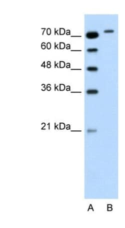 RHOBTB1 Antibody, Novus Biologicals 0.05mg; Unlabeled:Antibodies, Polyclonal