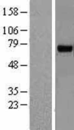 Novus Biologicals&trade;&nbsp;RHOBTB3 Overexpression Lysate