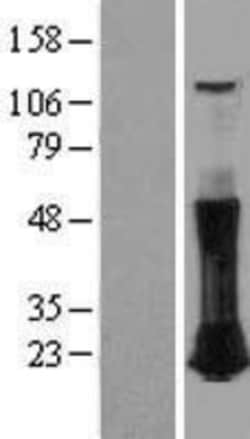 Novus Biologicals&trade;&nbsp;RhoC Overexpression Lysate