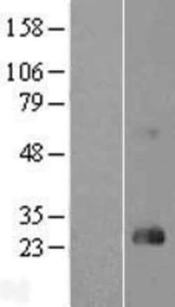 Novus Biologicals™ RhoD Overexpression Lysate
