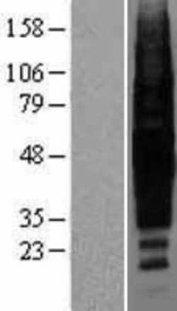 Novus Biologicals™ Rhodopsin Overexpression Lysate