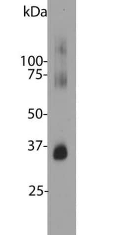 Rhodopsin Antibody (B630), Novus Biologicals 0.1mL; Unlabeled:Antibodies,