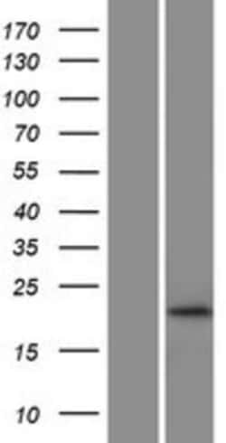 Novus Biologicals™ RhoG Overexpression Lysate