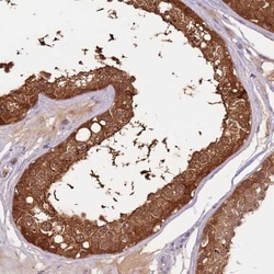 RhoGAP Antibody, Novus Biologicals 0.1mL; Unlabeled:Antibodies, Polyclonal