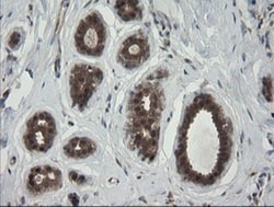 RhoJ Antibody (OTI1D7), Novus Biologicals 0.1mL; Unlabeled:Antibodies,