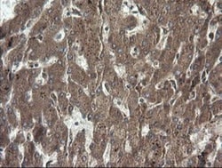 RhoJ Antibody (OTI1D7), Novus Biologicals 0.1mL; Unlabeled:Antibodies,