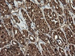 RhoJ Antibody (OTI1D7), Novus Biologicals 0.1mL; Unlabeled:Antibodies,