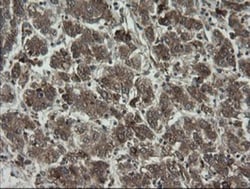 RhoJ Antibody (OTI1D7), Novus Biologicals 0.1mL; Unlabeled:Antibodies,