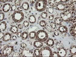 RhoJ Antibody (OTI1D7), Novus Biologicals 0.1mL; Unlabeled:Antibodies,