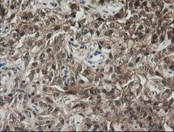 RhoJ Antibody (OTI1D7), Novus Biologicals 0.1mL; Unlabeled:Antibodies,