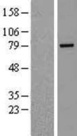 Novus Biologicals&trade;&nbsp;Rhophilin 2 Overexpression Lysate