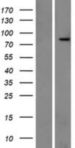Novus Biologicals&trade;&nbsp;Rhot1 Overexpression Lysate