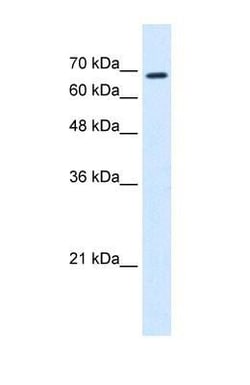 Rhot1 Antibody, Novus Biologicals 0.05mg; Unlabeled:Antibodies, Polyclonal