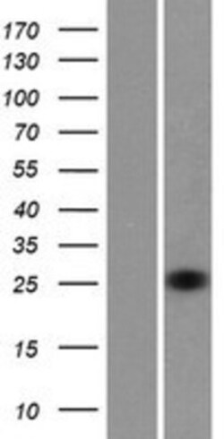 Novus Biologicals&trade;&nbsp;RhoV Overexpression Lysate