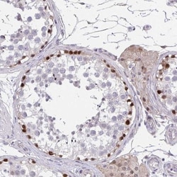 RHOXF1 Antibody, Novus Biologicals 0.1mL; Unlabeled:Antibodies, Polyclonal