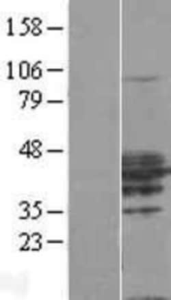 Novus Biologicals&trade;&nbsp;RHOXF2 Overexpression Lysate