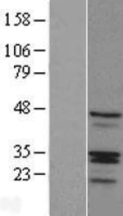 Novus Biologicals&trade;&nbsp;RIBC1 Overexpression Lysate