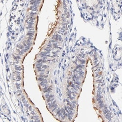 RIBC2 Antibody, Novus Biologicals 0.1mL; Unlabeled:Antibodies, Polyclonal