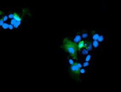 Ribonuclease Inhibitor Antibody (OTI1B7), Novus Biologicals 0.1mL; Unlabeled:Antibodies,