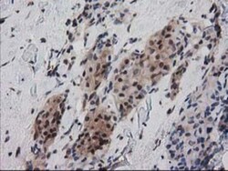 Ribonuclease Inhibitor Antibody (OTI1B7), Novus Biologicals 0.1mL; Unlabeled:Antibodies,