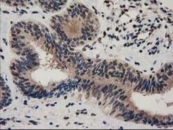 Ribonuclease Inhibitor Antibody (OTI1B7), Novus Biologicals 0.1mL; Unlabeled:Antibodies,