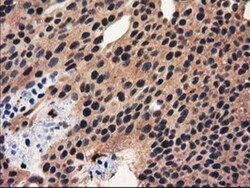 Ribonuclease Inhibitor Antibody (OTI1B7), Novus Biologicals 0.1mL; Unlabeled:Antibodies,