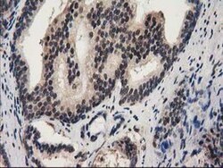 Ribonuclease Inhibitor Antibody (OTI1B7), Novus Biologicals 0.1mL; Unlabeled:Antibodies,