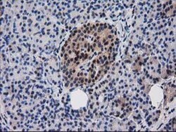 Ribonuclease Inhibitor Antibody (OTI1B7), Novus Biologicals 0.1mL; Unlabeled:Antibodies,