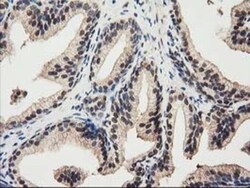 Ribonuclease Inhibitor Antibody (OTI1B7), Novus Biologicals 0.1mL; Unlabeled:Antibodies,