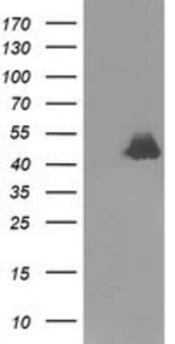 Ribonuclease Inhibitor Antibody (OTI1B7), Novus Biologicals 0.1mL; Unlabeled:Antibodies,