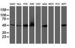 Ribonuclease Inhibitor Antibody (OTI1B7), Novus Biologicals 0.1mL; Unlabeled:Antibodies,