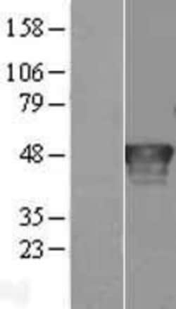 Novus Biologicals&trade;&nbsp;Ribonuclease Inhibitor Overexpression Lysate