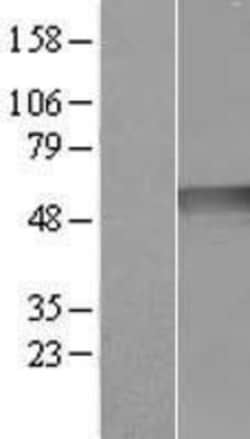 Novus Biologicals&trade;&nbsp;Ribonuclease Inhibitor Overexpression Lysate