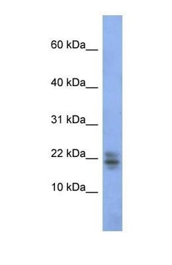 Ribonuclease A Antibody, Novus Biologicals 0.05mg; Unlabeled:Antibodies,