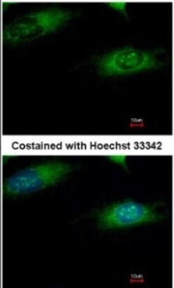Ribophorin I Antibody, Novus Biologicals 0.1mg; Unlabeled:Antibodies, Polyclonal