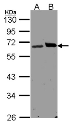 Ribophorin I Antibody, Novus Biologicals 0.1mg; Unlabeled:Antibodies, Polyclonal