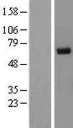Novus Biologicals™ Ribophorin II Overexpression Lysate