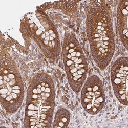 Ribosomal Protein L24 Antibody, Novus Biologicals 0.1mL; Unlabeled:Antibodies,
