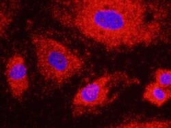 Ribosomal protein L26 Antibody, Novus Biologicals 0.1mg; Unlabeled:Antibodies,