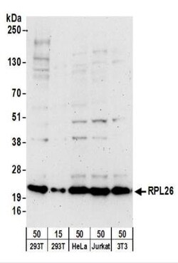 Ribosomal protein L26 Antibody, Novus Biologicals 0.1mg; Unlabeled:Antibodies,