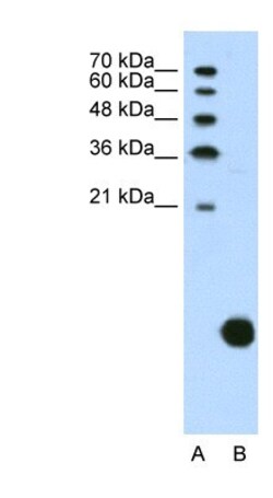 Ribosomal Protein S29 Antibody, Novus Biologicals 0.1mg; Unlabeled:Antibodies,