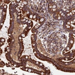 RIC8B Antibody, Novus Biologicals:Antibodies:Primary Antibodies