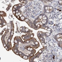 RICS Antibody, Novus Biologicals 0.1mL; Unlabeled:Antibodies, Polyclonal