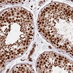 Rif1 Antibody, Novus Biologicals 0.1mL; Unlabeled:Antibodies, Polyclonal