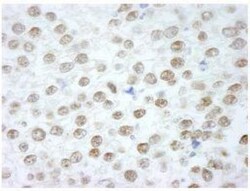 Rif1 Antibody, Novus Biologicals 100 &mu;L | Buy Online | Novus Biologicals | Fisher Scientific
