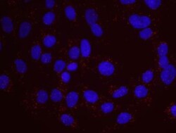 Rif1 Antibody, Novus Biologicals 100 &mu;L | Buy Online | Novus Biologicals | Fisher Scientific